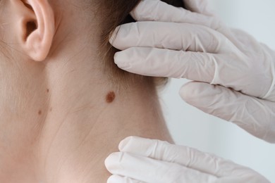 Doctor examining woman's mole in clinic, closeup