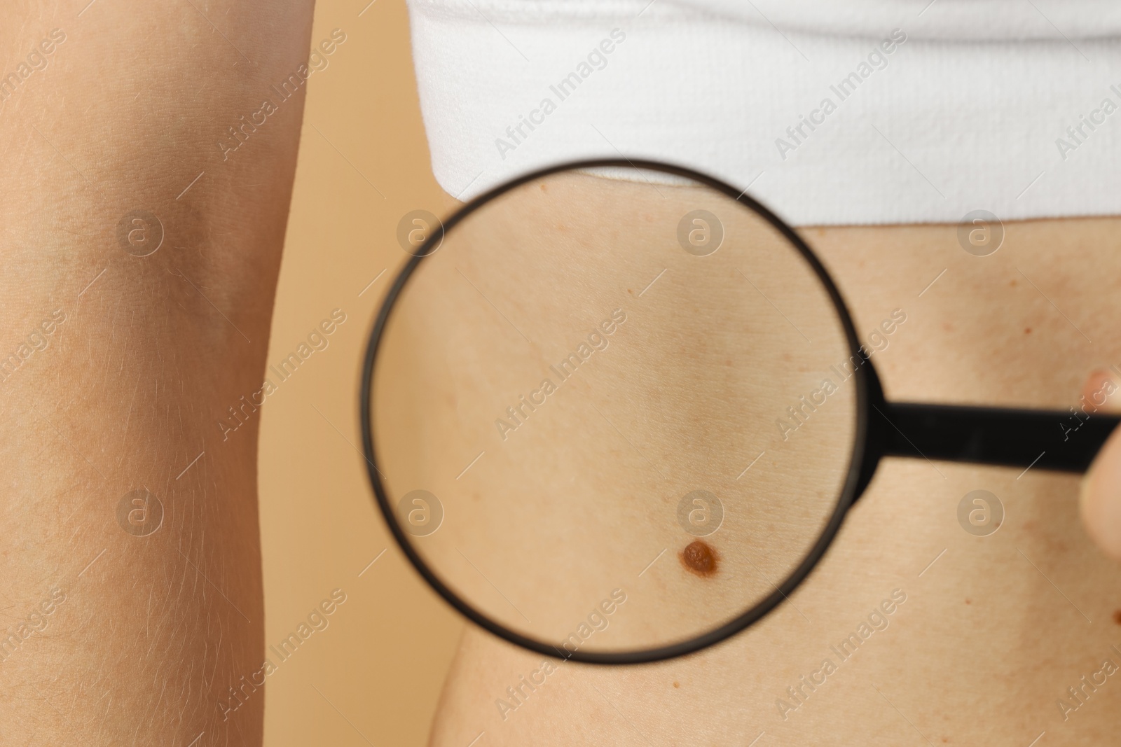 Photo of Doctor examining woman's mole with magnifying glass on beige background, closeup