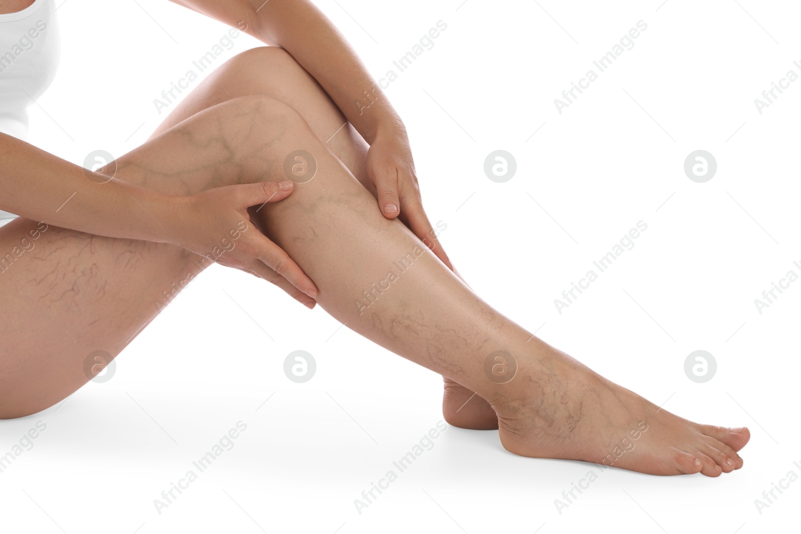 Photo of Woman suffering from varicose veins on white background, closeup