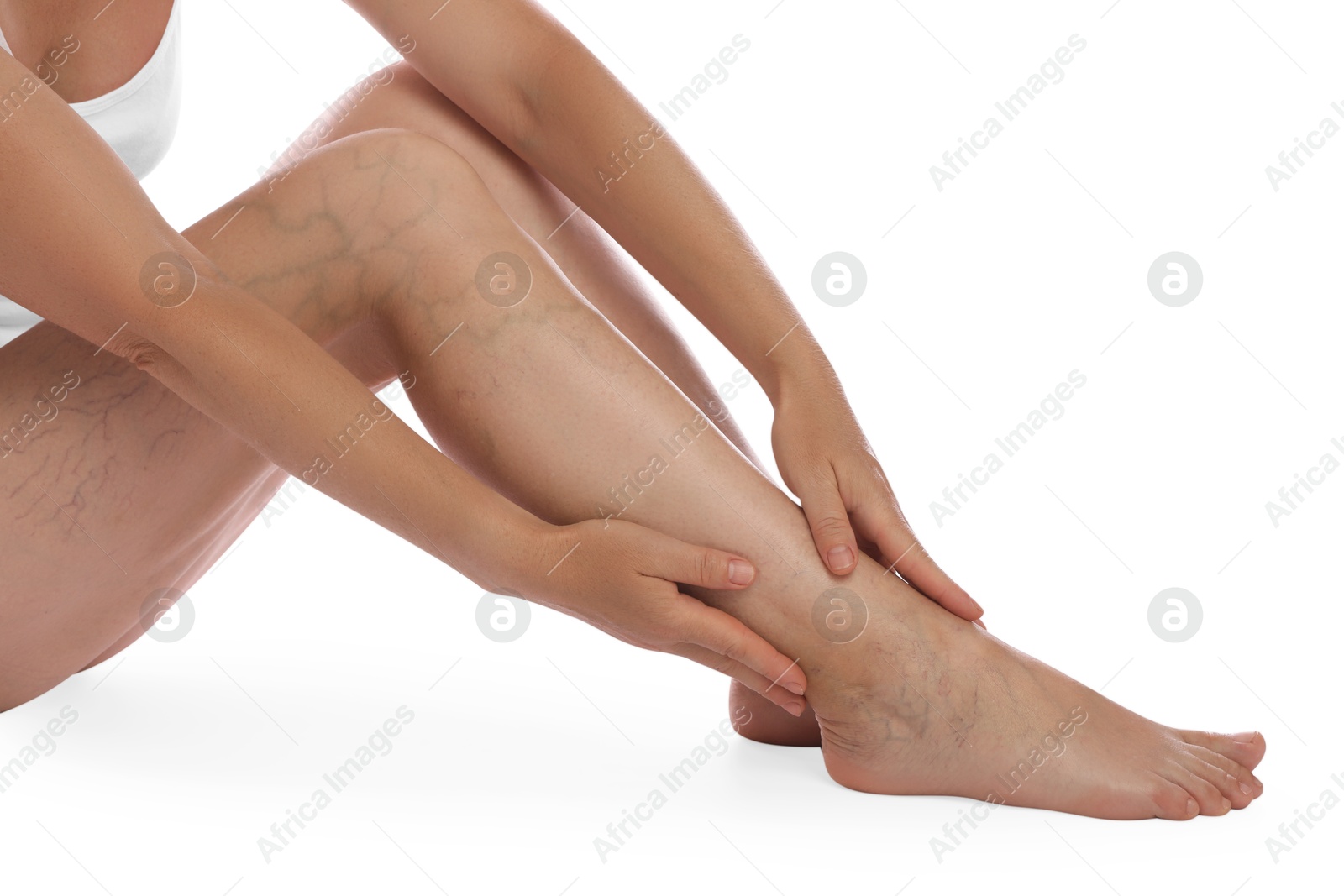 Photo of Woman suffering from varicose veins on white background, closeup