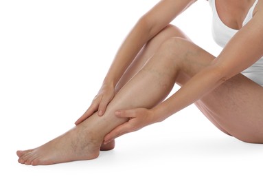 Photo of Woman suffering from varicose veins on white background, closeup