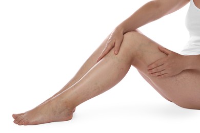 Photo of Woman suffering from varicose veins on white background, closeup