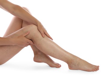 Photo of Woman suffering from varicose veins on white background, closeup