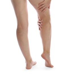 Photo of Woman suffering from varicose veins on white background, closeup