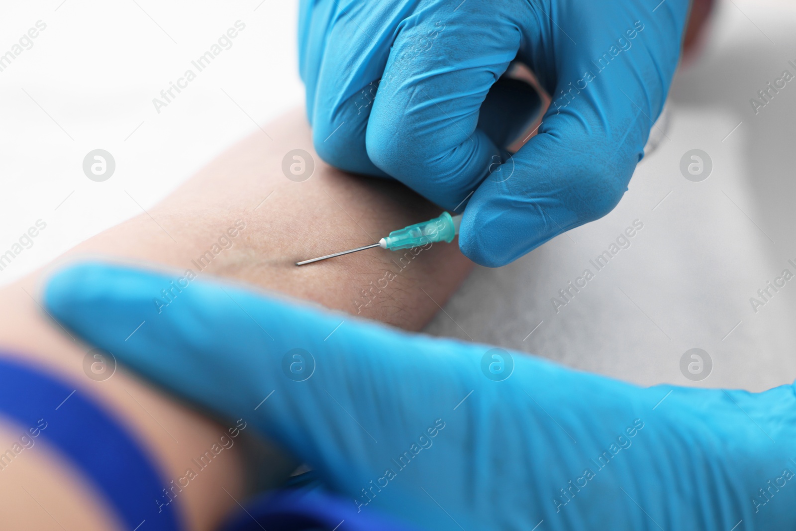 Photo of Nurse inserting IV into arm of patient in hospital, closeup