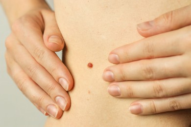 Woman with mole on her skin against light grey background, closeup