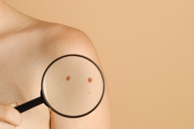 Doctor examining woman's mole with magnifying glass on beige background, closeup