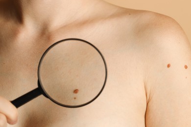 Doctor examining woman's mole with magnifying glass, closeup