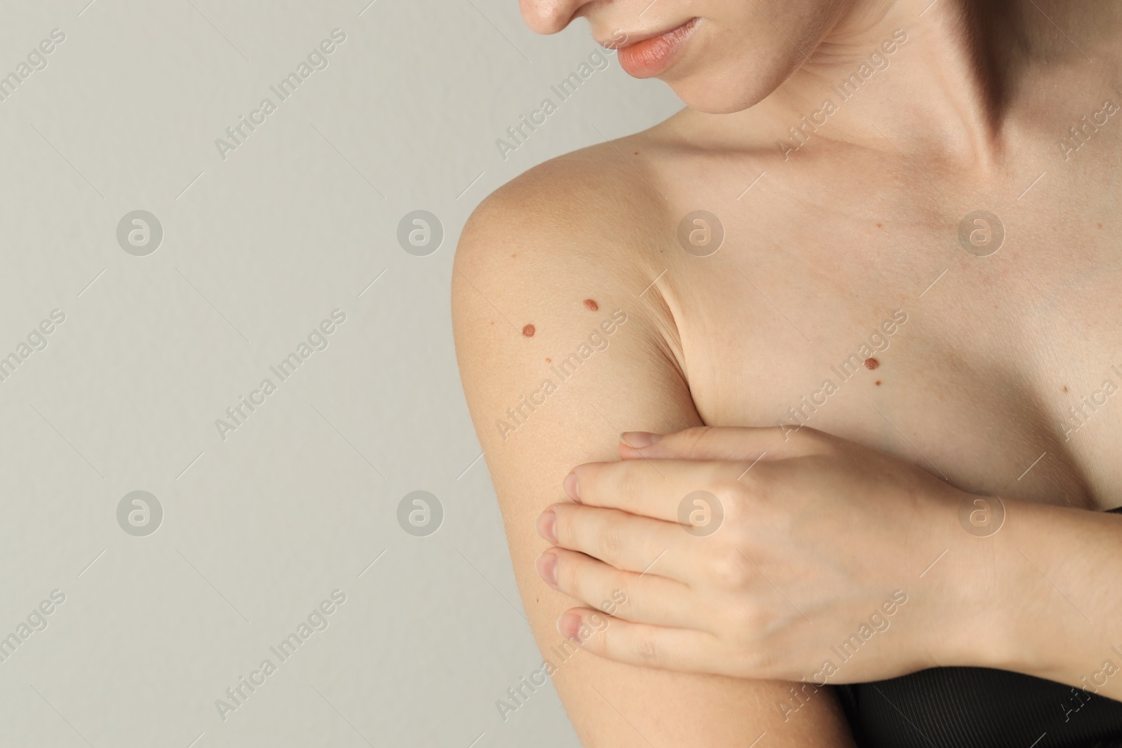 Photo of Woman with moles on her skin against light grey background, closeup. Space for text