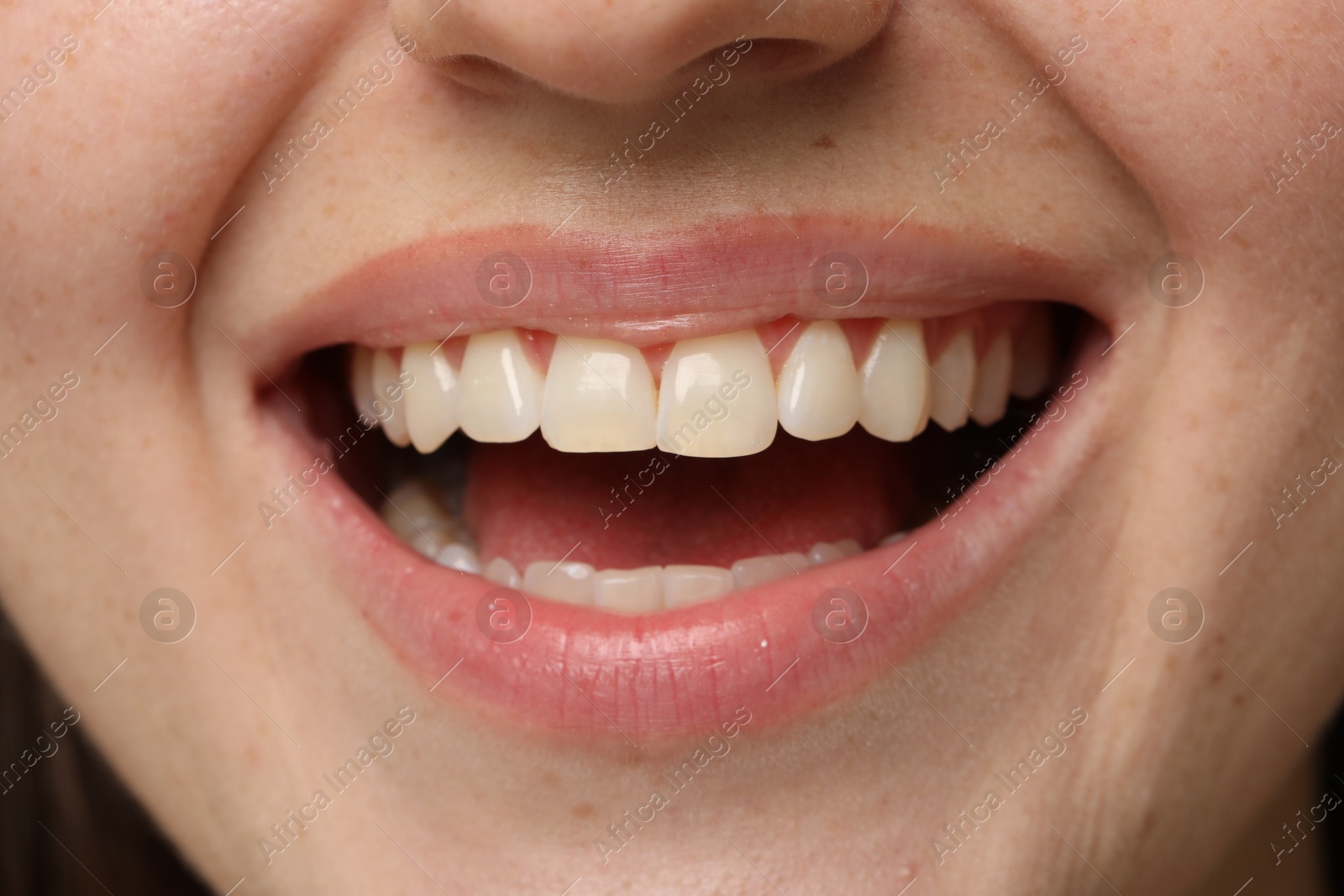 Photo of Smiling woman with healthy clean teeth, closeup