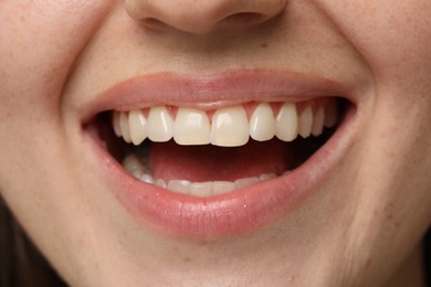 Smiling woman with healthy clean teeth, closeup