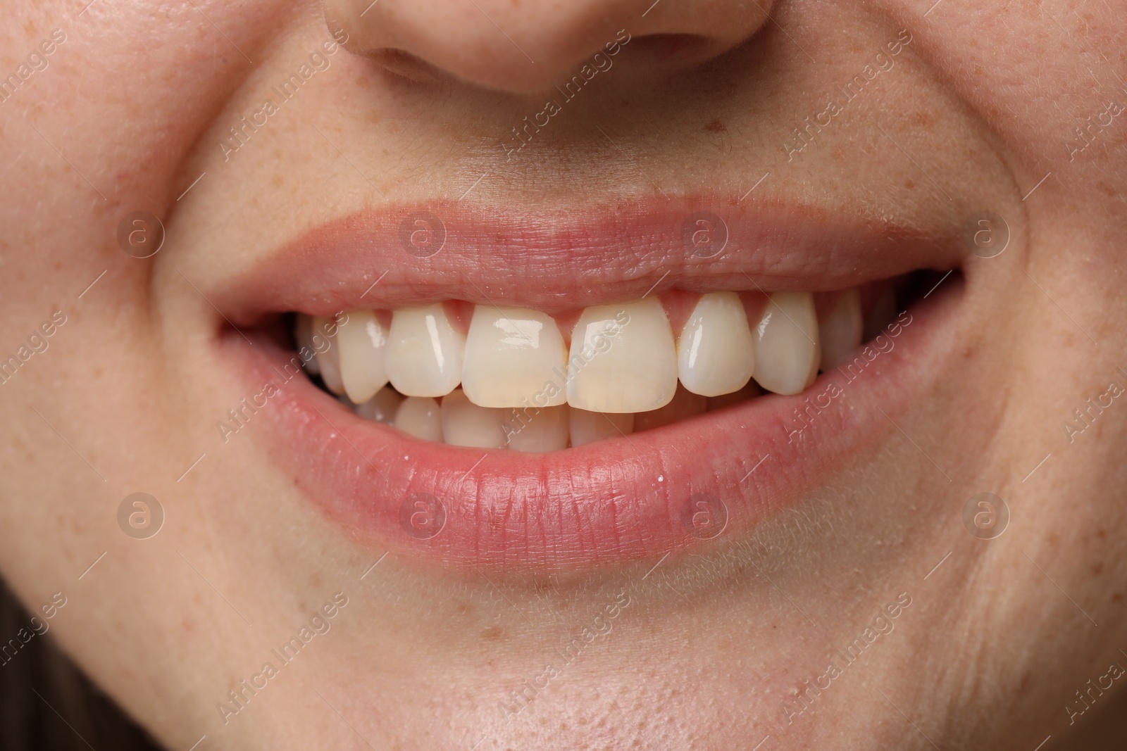 Photo of Smiling woman with healthy clean teeth, closeup