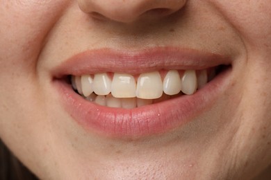 Smiling woman with healthy clean teeth, closeup