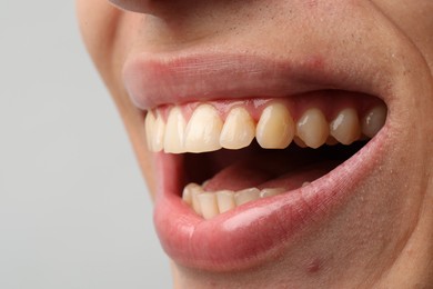 Smiling man with healthy clean teeth on light background, closeup