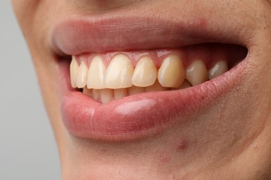 Smiling man with healthy clean teeth on light background, closeup