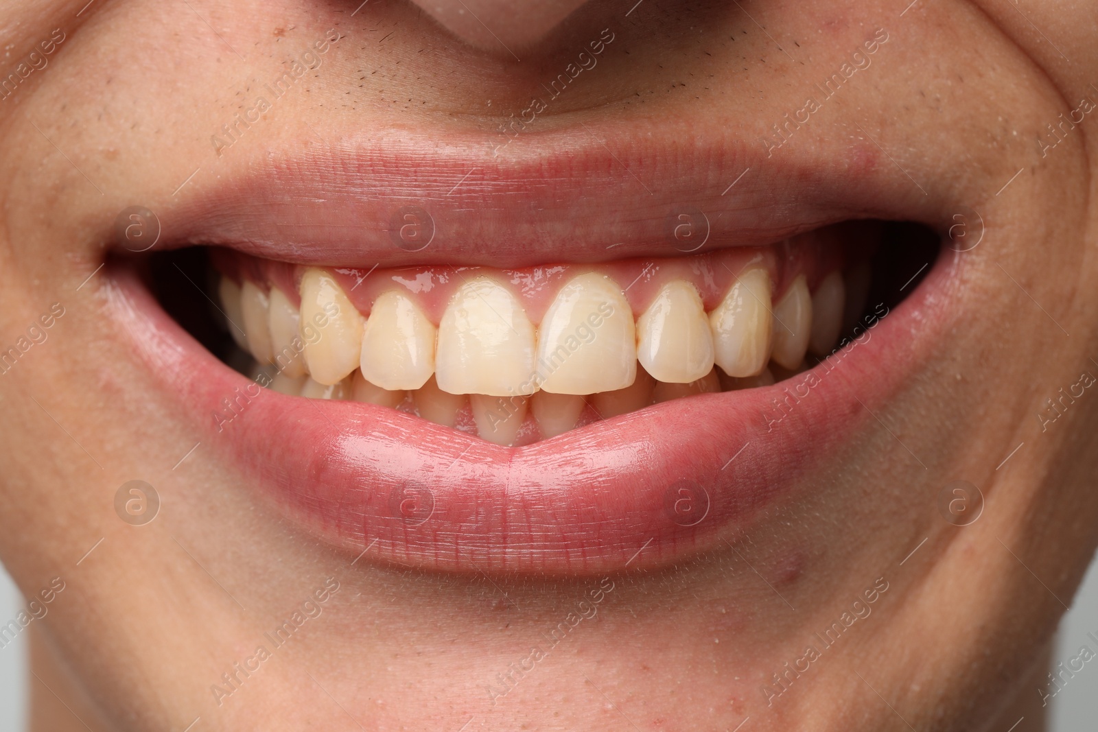 Photo of Smiling man with healthy clean teeth, closeup