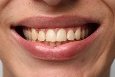 Smiling man with healthy clean teeth, closeup