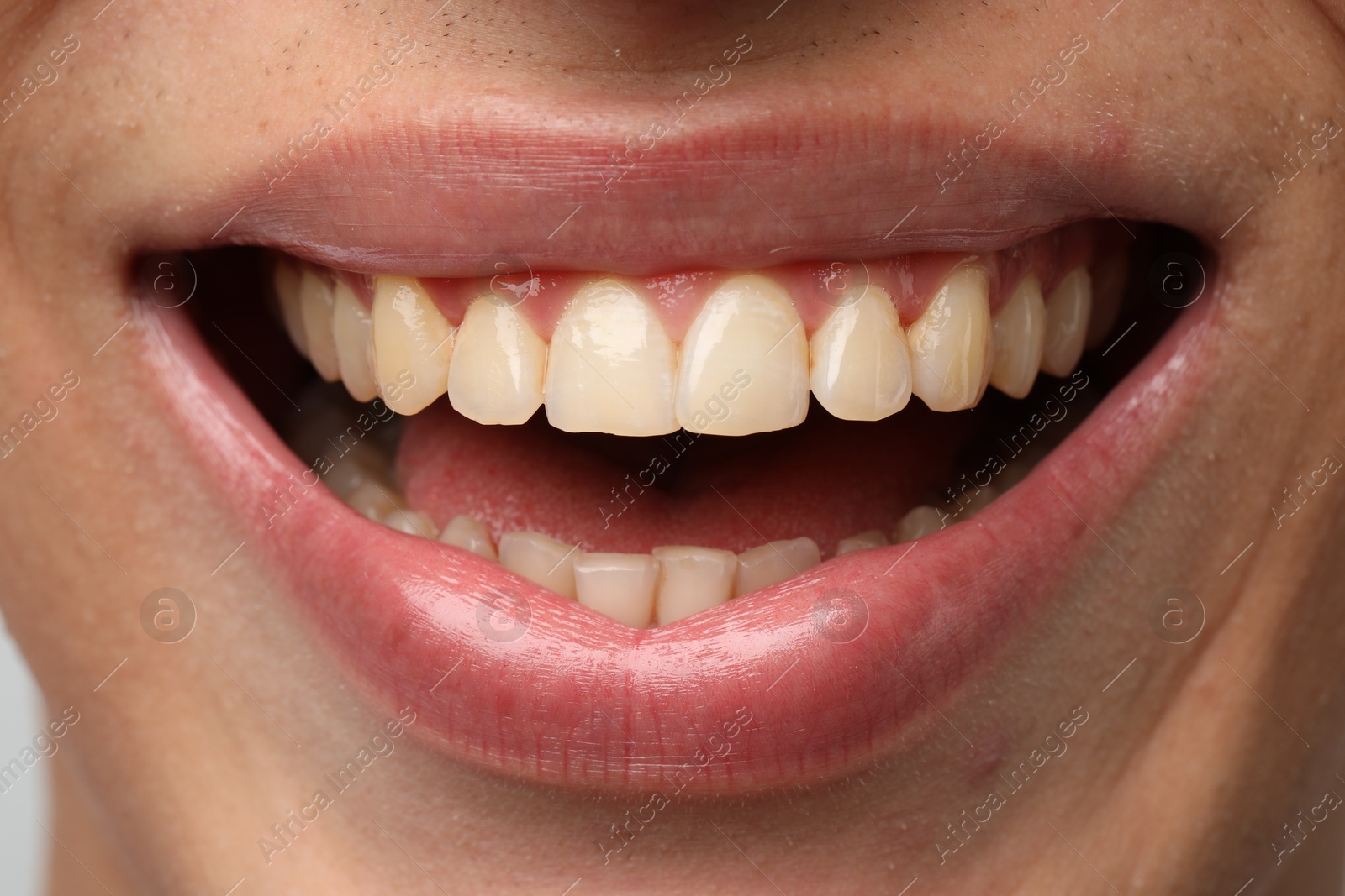 Photo of Smiling man with healthy clean teeth, closeup