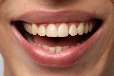 Photo of Smiling man with healthy clean teeth, closeup