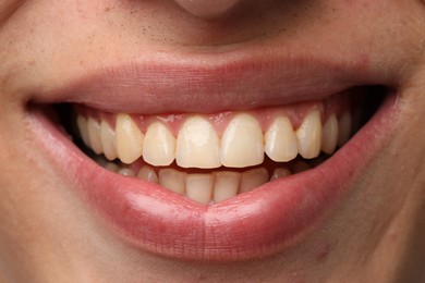 Photo of Smiling man with healthy clean teeth, closeup