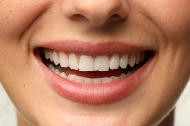 Smiling woman with healthy clean teeth, closeup