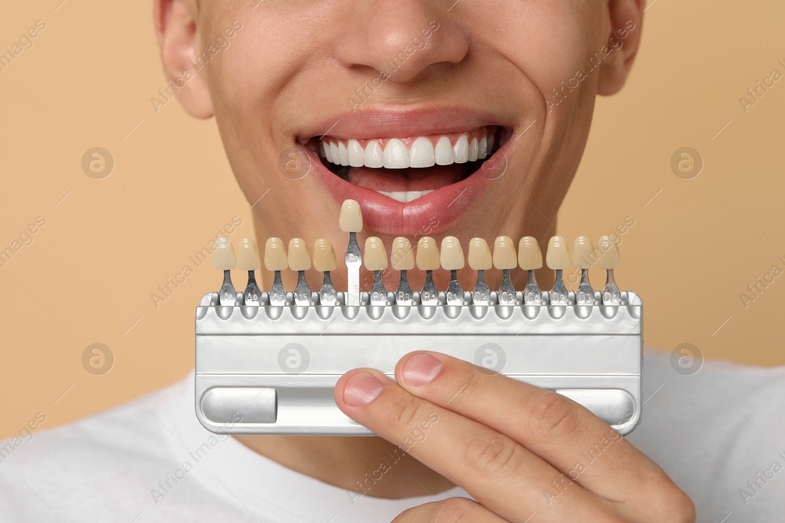 Photo of Happy young man with teeth color samples on beige background, closeup. Dental veneers