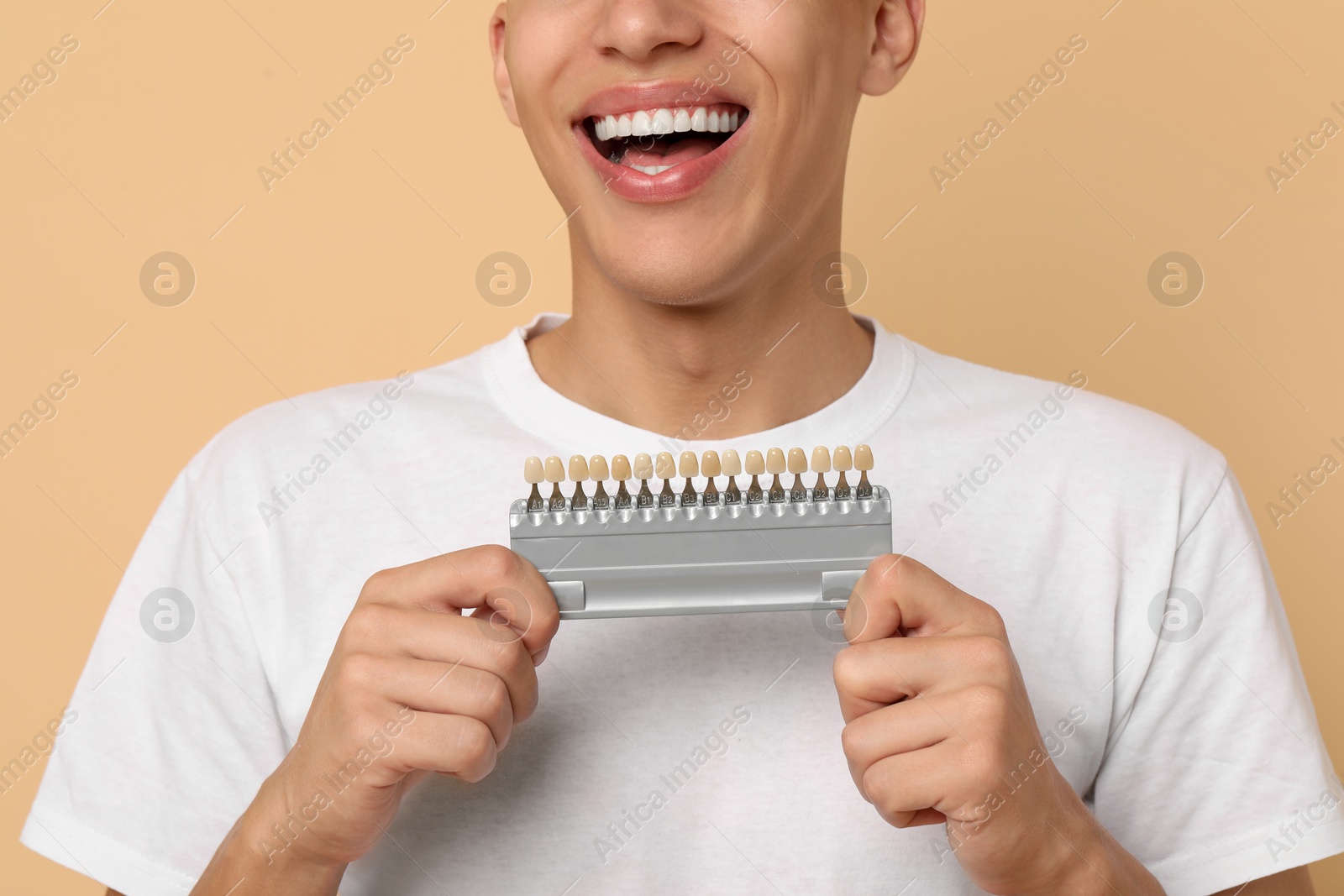 Photo of Happy young man with teeth color samples on beige background, closeup. Dental veneers