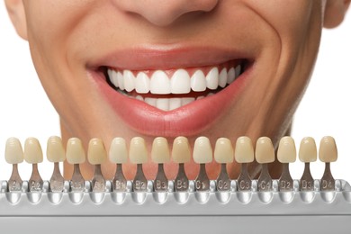 Photo of Happy young man with teeth color samples on white background, closeup. Dental veneers