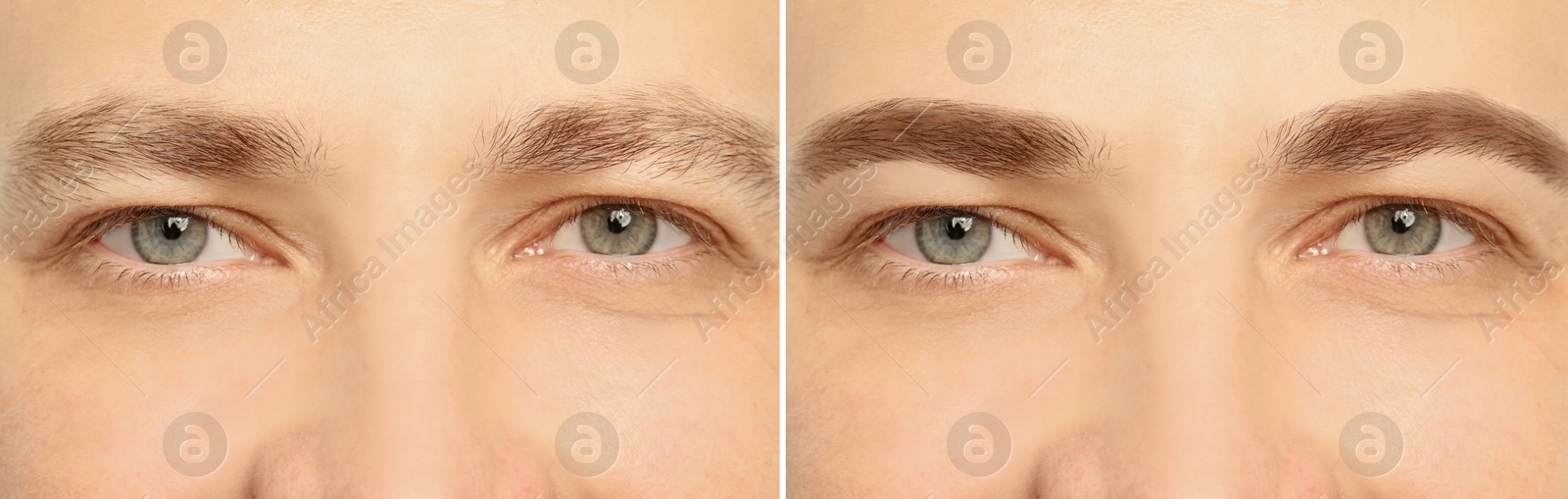 Image of Man before and after permanent eyebrow procedure, collage with closeup photos