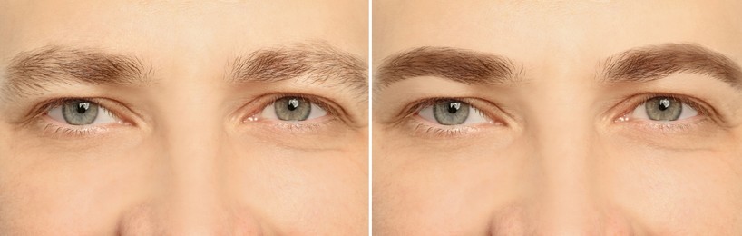 Image of Man before and after permanent eyebrow procedure, collage with closeup photos