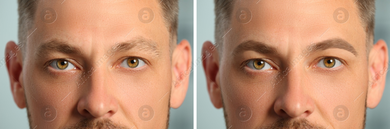 Image of Man before and after permanent eyebrow procedure, collage with closeup photos