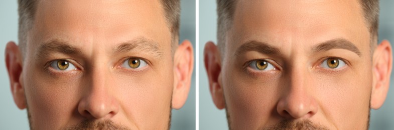 Image of Man before and after permanent eyebrow procedure, collage with closeup photos