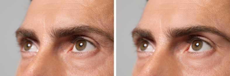 Man before and after permanent eyebrow procedure, collage with closeup photos