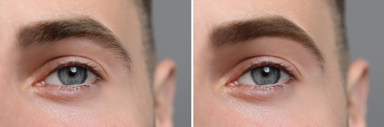 Man before and after permanent eyebrow procedure, collage with closeup photos