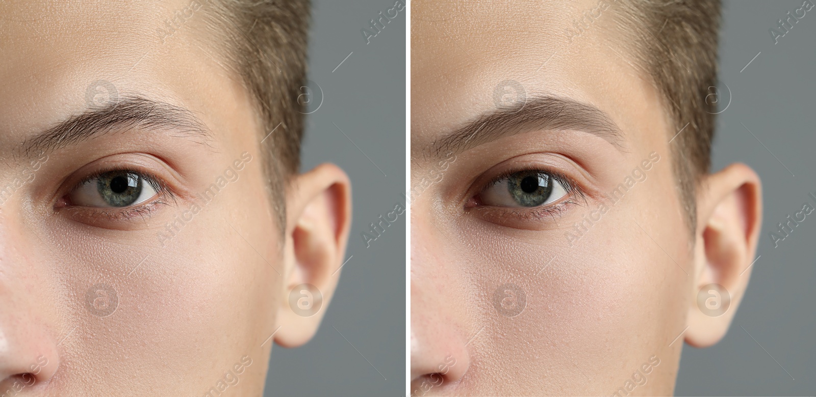 Image of Man before and after permanent eyebrow procedure, collage with closeup photos