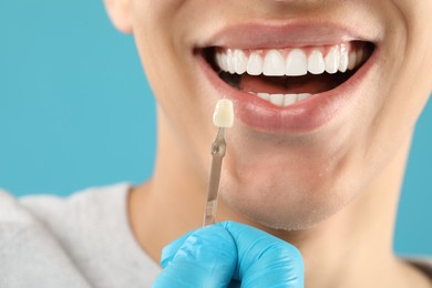 Photo of Doctor checking young man's teeth color on light blue background, closeup. Dental veneers