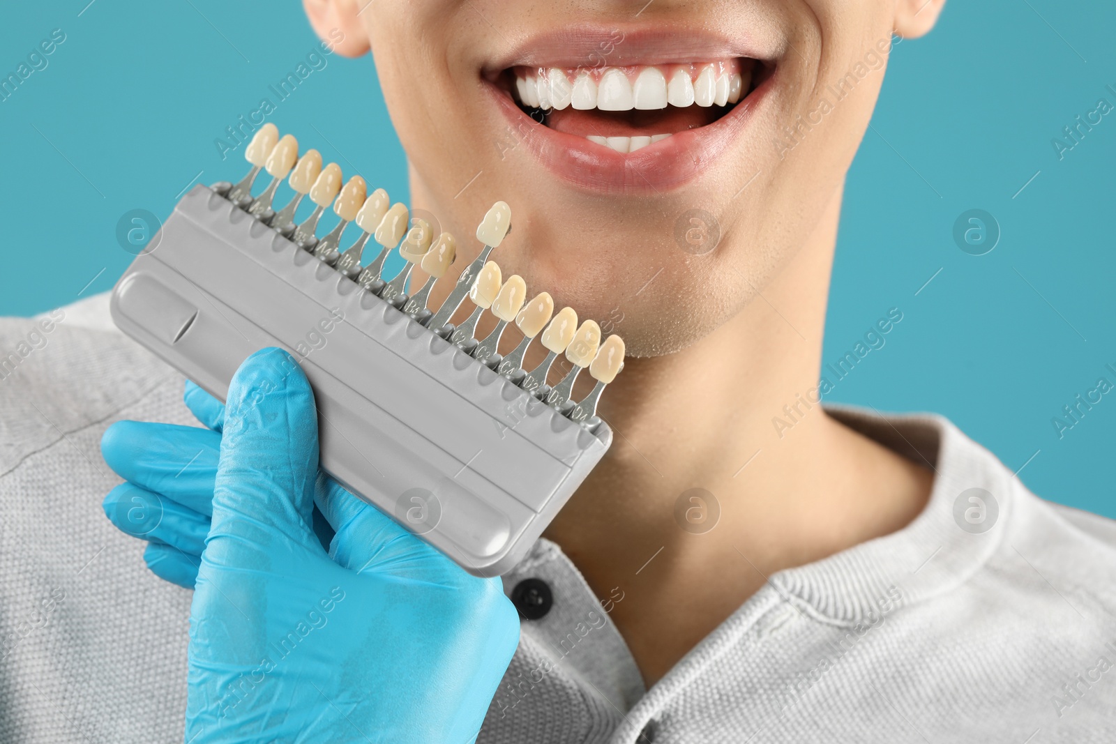 Photo of Doctor checking young man's teeth color on light blue background, closeup. Dental veneers