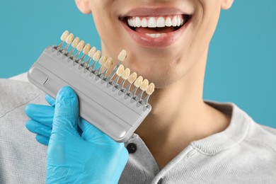 Photo of Doctor checking young man's teeth color on light blue background, closeup. Dental veneers