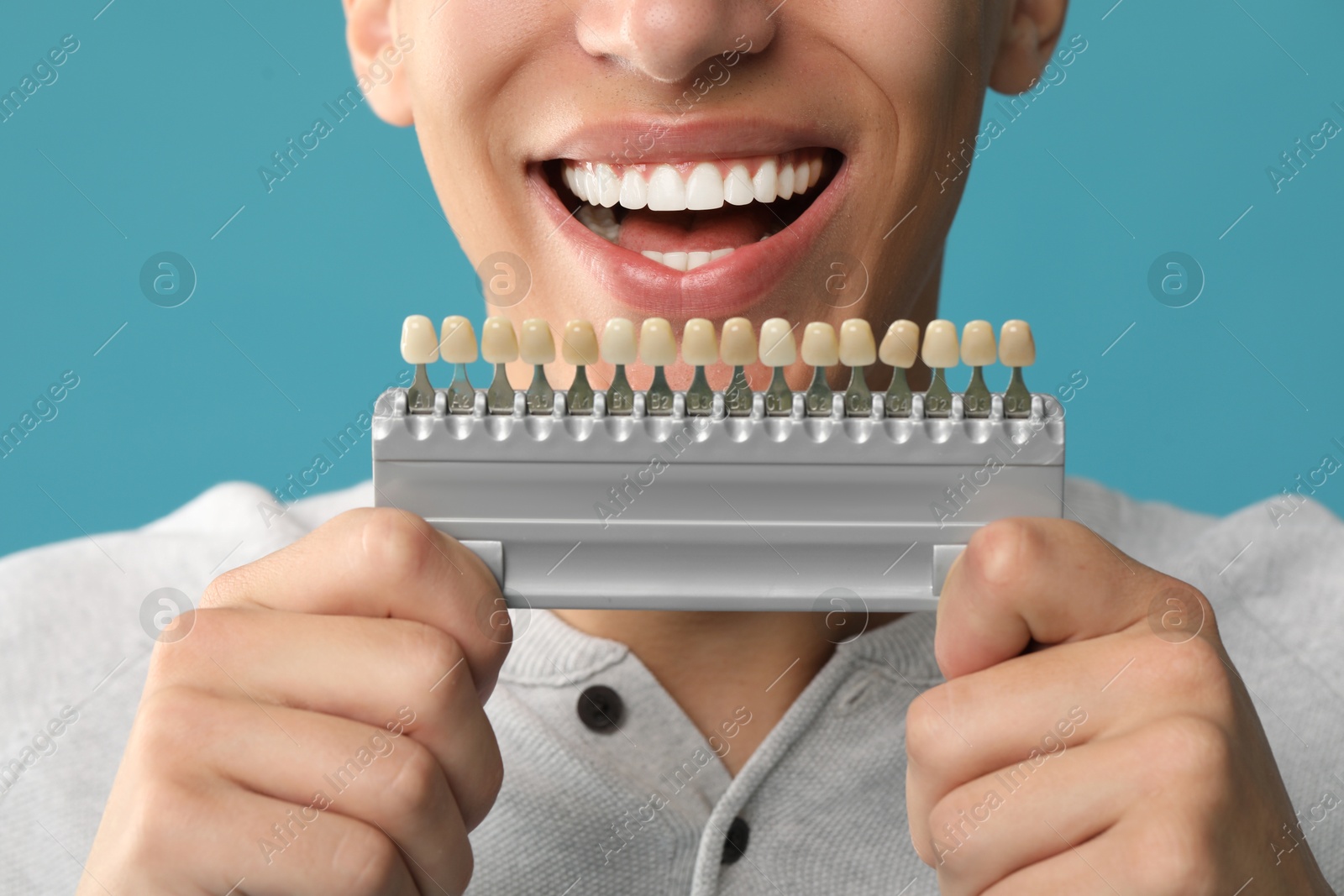 Photo of Happy young man with teeth color samples on light blue background, closeup. Dental veneers