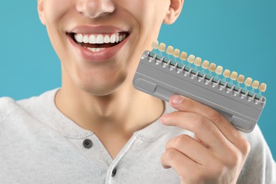 Photo of Happy young man with teeth color samples on light blue background, closeup. Dental veneers