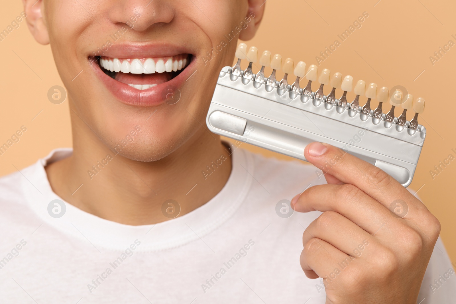 Photo of Happy young man with teeth color samples on beige background, closeup. Dental veneers