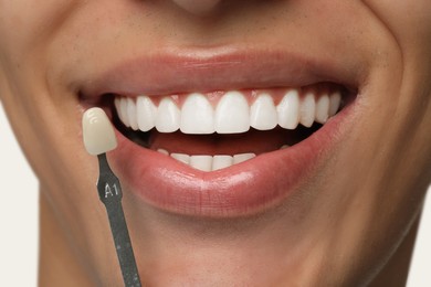 Young man with teeth color sample on white background, closeup. Dental veneers