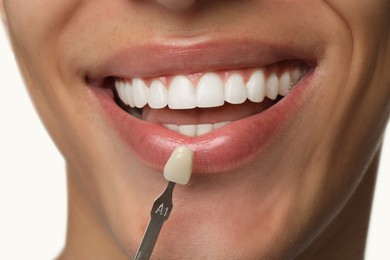 Young man with teeth color sample on white background, closeup. Dental veneers