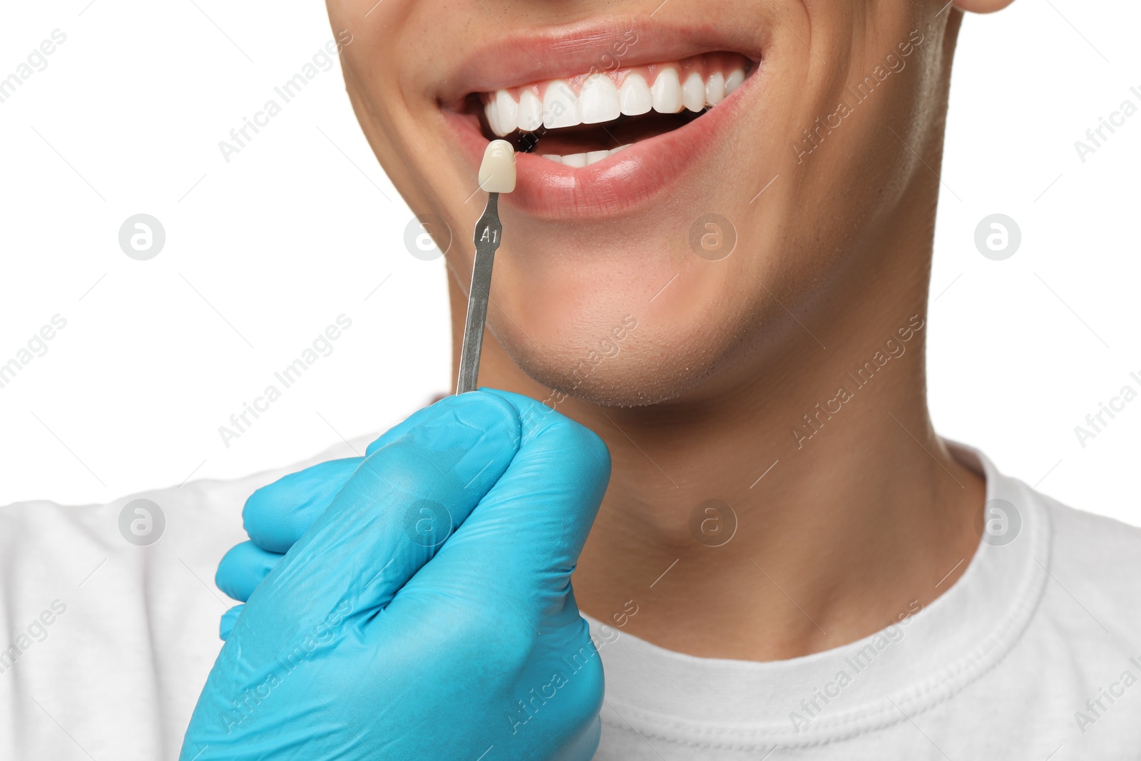 Photo of Doctor checking young man's teeth color on white background, closeup. Dental veneers