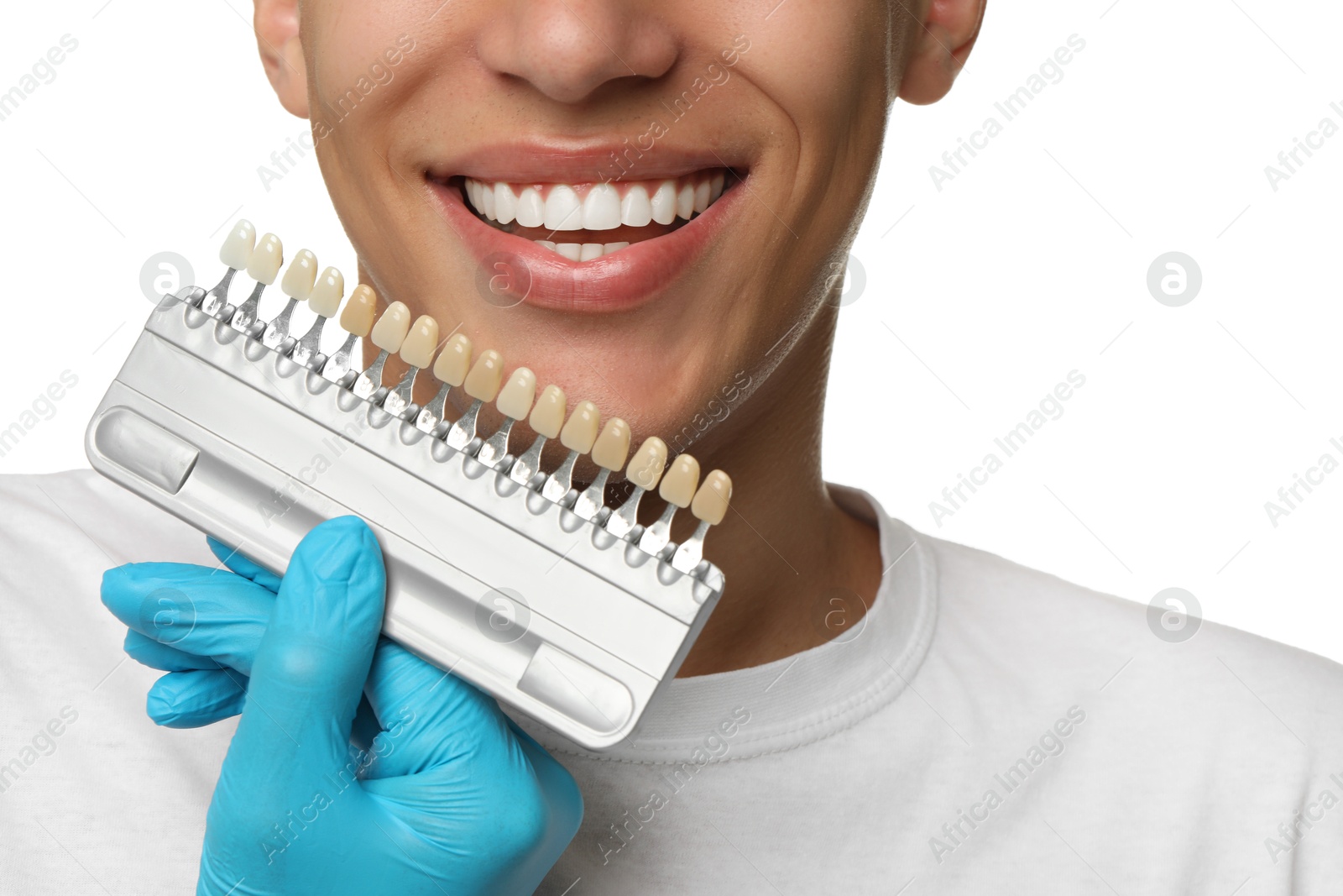 Photo of Doctor checking young man's teeth color on white background, closeup. Dental veneers