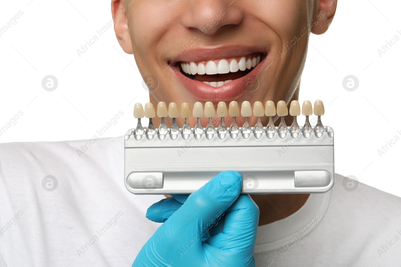 Photo of Doctor checking young man's teeth color on white background, closeup. Dental veneers