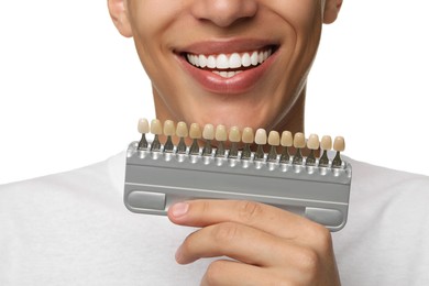 Photo of Happy young man with teeth color samples on white background, closeup. Dental veneers