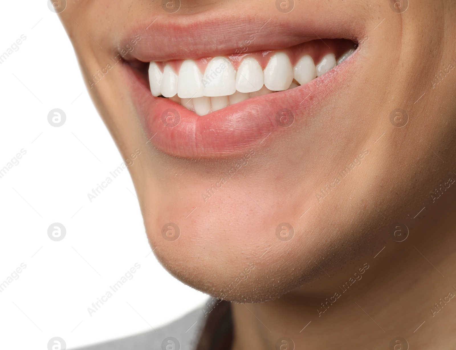 Photo of Happy young man on white background, closeup. Dental veneers