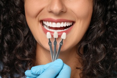 Doctor checking young woman's teeth color, closeup. Dental veneers