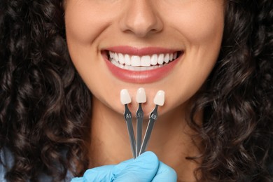 Photo of Doctor checking young woman's teeth color, closeup. Dental veneers